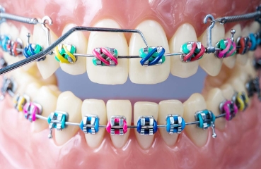 Orthodontistry