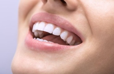 Cosmetic Dentistry
