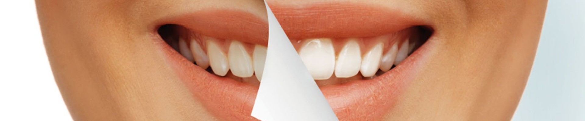 Dental Services in Beirut | Smile to Smile Clinics